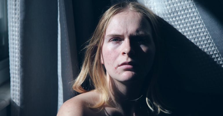 Jak zwalczyć zmiany potrądzikowe?